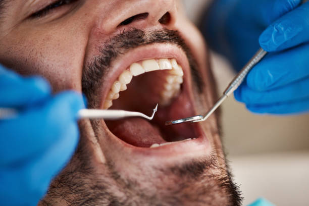 Best Emergency Dental Care for Broken or Chipped Teeth in Mount Healthy, OH